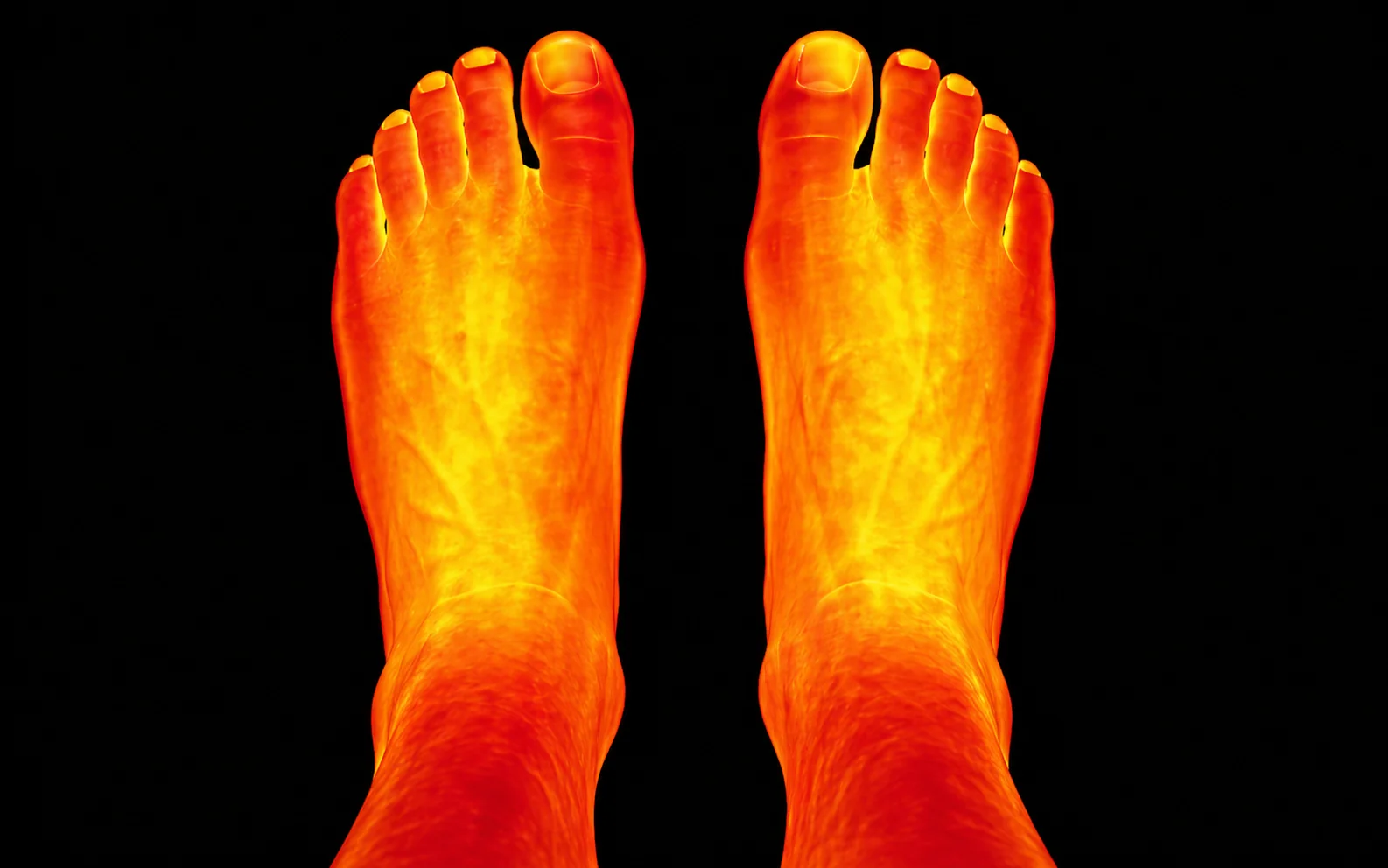 Termografia post-sessione