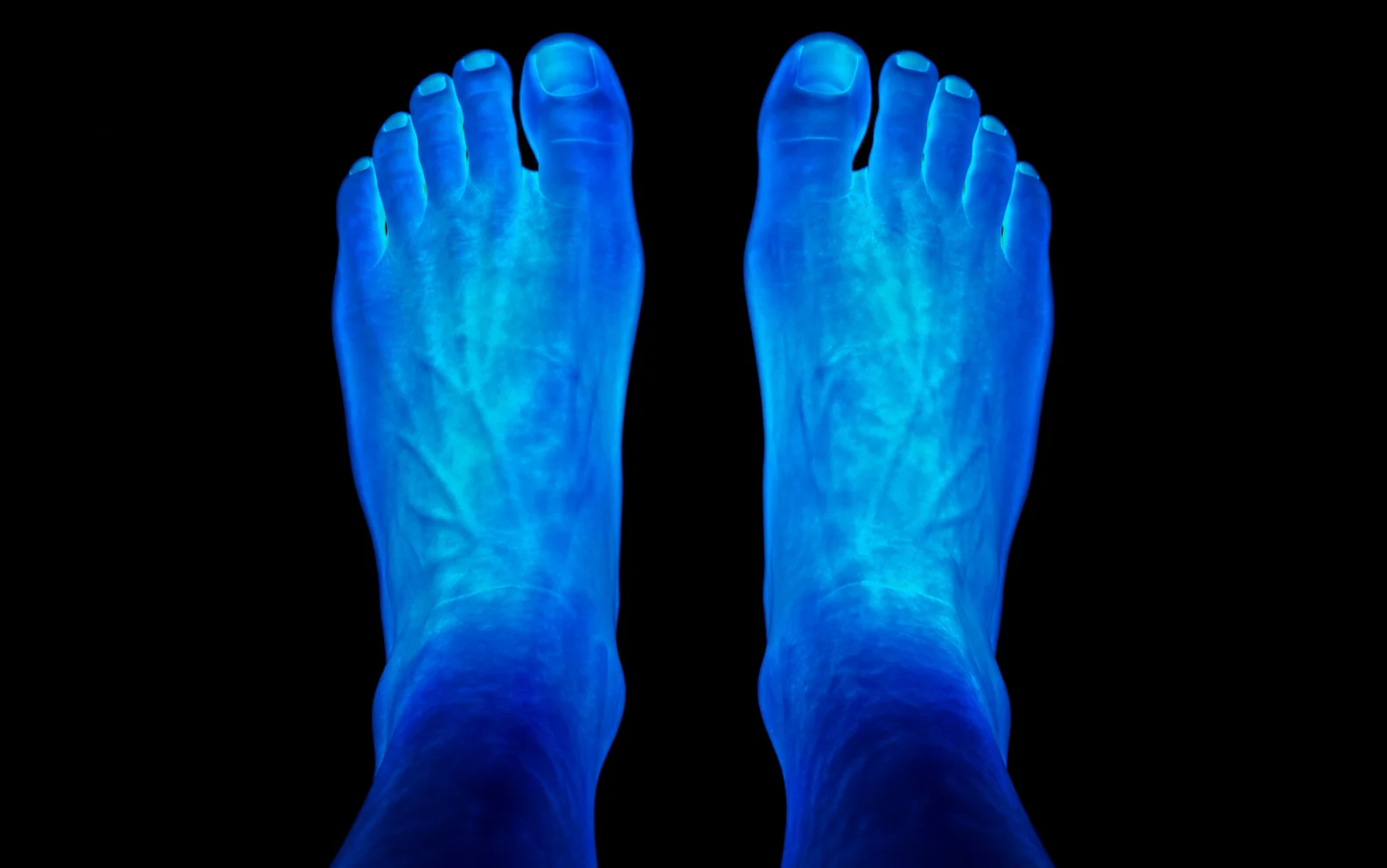 Termografia baseline